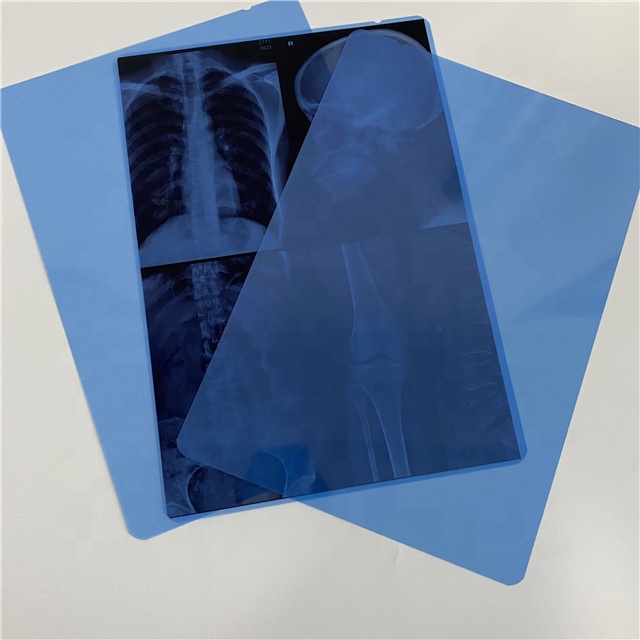 X ray Film /Medical X ray Film/ medical consumbable 11*14 inch green /blue sensitive